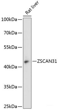 Immunofluorescence analysis of HeLa cells using CCT6B Polyclonal Antibody at dilution of  1:100. Blue: DAPI for nuclear staining.