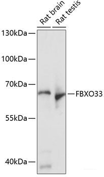 Immunohistochemistry of paraffin-embedded Human colon using CYP2B6 Polyclonal Antibody at dilution of  1:100 (40x lens).