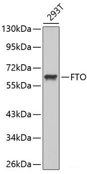 Immunohistochemistry of paraffin-embedded Rat kidney using NDUFAB1 Polyclonal Antibody at dilution of  1:100 (40x lens).