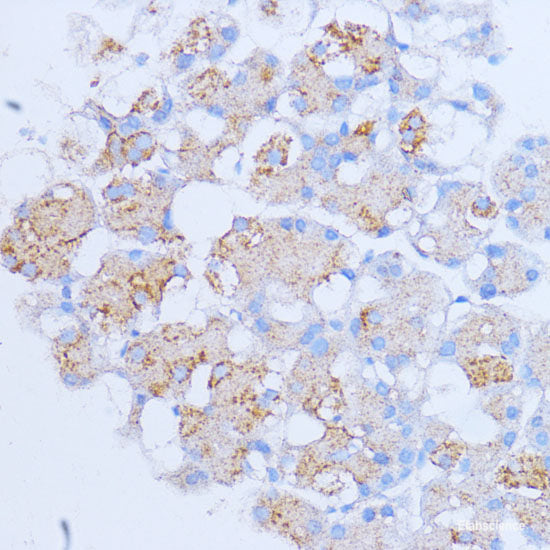 Immunofluorescence analysis of Human colon carcinoma cells using MUC2 Polyclonal Antibody at dilution of  1:100. Blue: DAPI for nuclear staining.