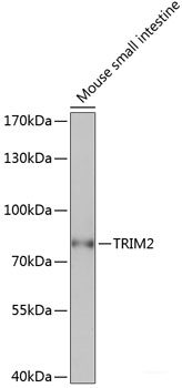 Immunohistochemistry of paraffin-embedded Rat brain using GFAP Polyclonal Antibody at dilution of  1:200 (40x lens).
