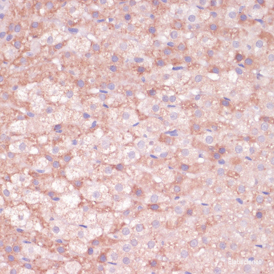 Immunofluorescence analysis of HeLa cells using CALM1 Polyclonal Antibody at dilution of  1:100 (40x lens). Blue: DAPI for nuclear staining.