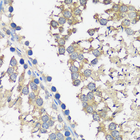 Immunofluorescence analysis of NIH-3T3 cells using CSNK2B Polyclonal Antibody at dilution of  1:100 (40x lens). Blue: DAPI for nuclear staining.