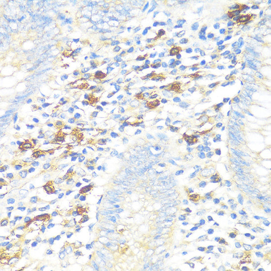 Immunohistochemistry of paraffin-embedded Rat ovary using ALDH6A1 Polyclonal Antibody at dilution of  1:100 (40x lens).