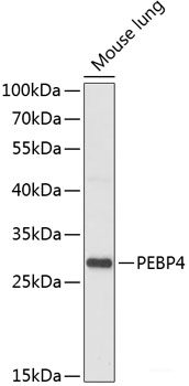 Immunohistochemistry of paraffin-embedded Human stomach using PAEP Polyclonal Antibody at dilution of  1:100 (40x lens).
