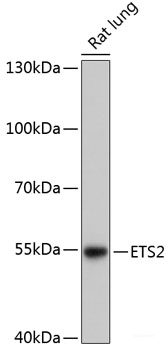 Immunohistochemistry of paraffin-embedded Human colon using SERPINE1 Polyclonal Antibody at dilution of  1:100 (40x lens).