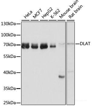 Immunofluorescence analysis of U2OS cells using XBP1 Polyclonal Antibody at dilution of  1:100. Blue: DAPI for nuclear staining.