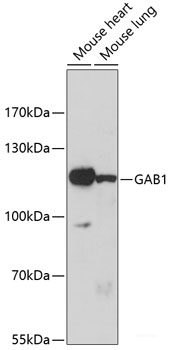 Immunohistochemistry of paraffin-embedded Mouse lung using ZNF141 Polyclonal Antibody at dilution of  1:100 (40x lens).