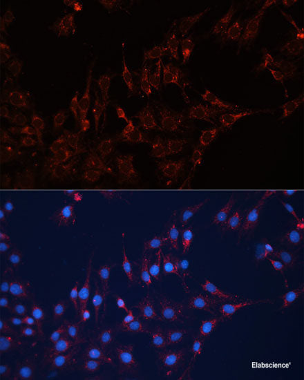 Immunohistochemistry of paraffin-embedded Human liver using SLC5A6 Polyclonal Antibody at dilution of  1:100 (40x lens).