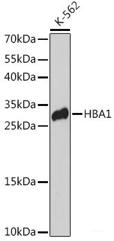Immunohistochemistry of paraffin-embedded Mouse testis using DDX21 Polyclonal Antibody at dilution of  1:100 (40x lens).