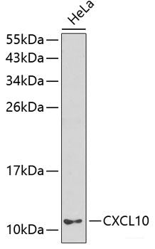 Immunofluorescence analysis of 293T cells using SLC25A17 Polyclonal Antibody at dilution of  1:100 (40x lens). Blue: DAPI for nuclear staining.