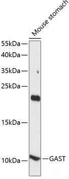 Immunohistochemistry of paraffin-embedded Human appendix using ERLIN1 Polyclonal Antibody at dilution of  1:100 (40x lens).