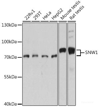 Immunohistochemistry of paraffin-embedded Rat testis using PSIP1 Polyclonal Antibody at dilution of  1:100 (40x lens).