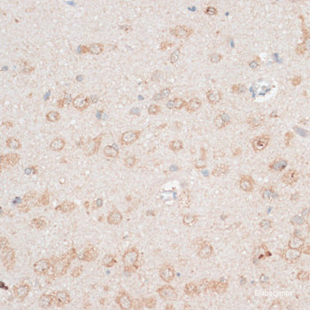 Immunofluorescence analysis of Rat testis using OXCT2 Polyclonal Antibody at dilution of  1:100. Blue: DAPI for nuclear staining.