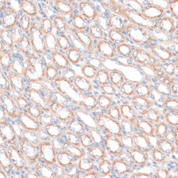 Immunofluorescence analysis of L929 cells using NTPCR Polyclonal Antibody at dilution of  1:100. Blue: DAPI for nuclear staining.