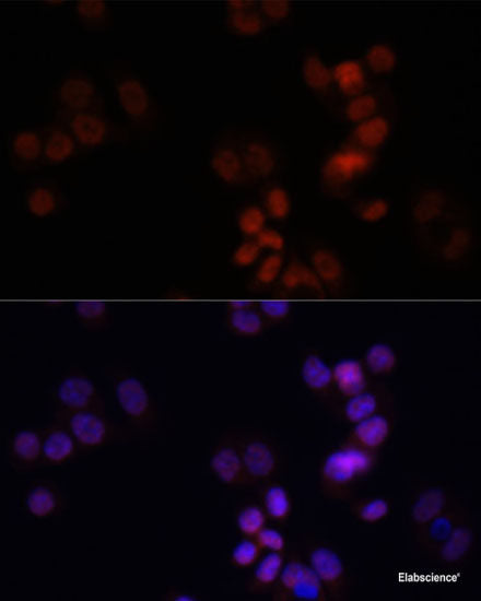 Immunohistochemistry of paraffin-embedded Rat brain using Osteopontin Polyclonal Antibody at dilution of  1:100 (40x lens).
