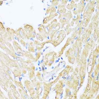 Immunofluorescence analysis of NIH/3T3 cells using YTHDC2 Polyclonal Antibody at dilution of  1:100. Blue: DAPI for nuclear staining.