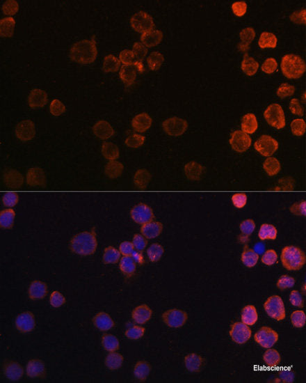 Immunohistochemistry of paraffin-embedded Rat spleen using AARS Polyclonal Antibody at dilution of  1:100 (40x lens).