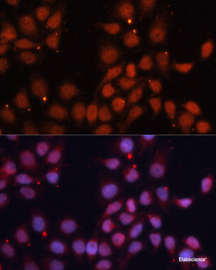 Immunofluorescence analysis of HeLa cells using ACAA1 Polyclonal Antibody at dilution of  1:100 (40x lens). Blue: DAPI for nuclear staining.