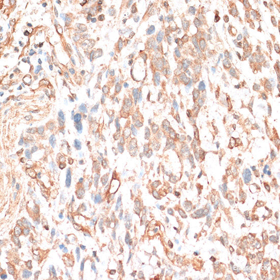 Immunohistochemistry of paraffin-embedded Rat brain using ACADSB Polyclonal Antibody at dilution of  1:100 (40x lens).