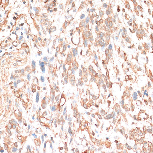 Immunohistochemistry of paraffin-embedded Rat brain using ACADSB Polyclonal Antibody at dilution of  1:100 (40x lens).