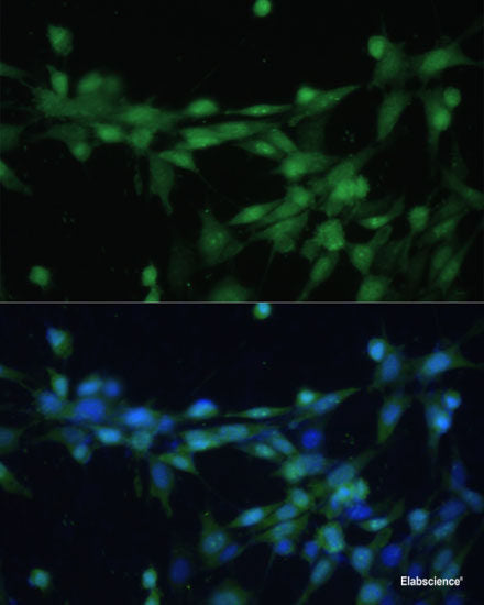 Immunofluorescence analysis of HeLa cells using ACP1 Polyclonal Antibody at dilution of  1:100 (40x lens). Blue: DAPI for nuclear staining.