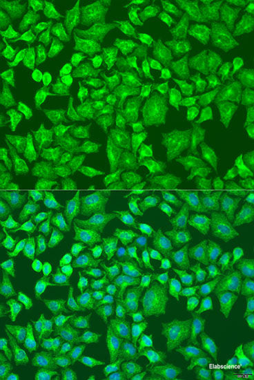 Immunofluorescence analysis of HeLa cells using ACYP1 Polyclonal Antibody at dilution of  1:100 (40x lens). Blue: DAPI for nuclear staining.