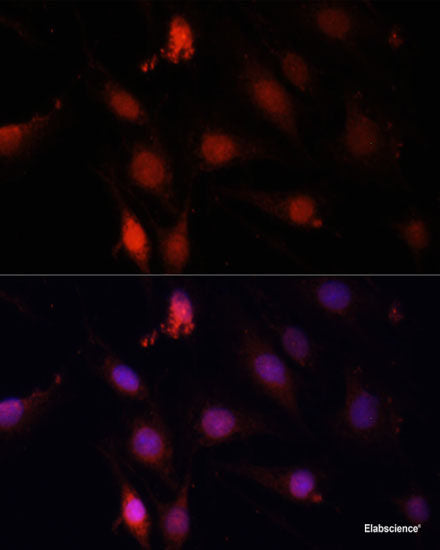 Immunofluorescence analysis of HeLa cells using ADAM8 Polyclonal Antibody at dilution of  1:100 (40x lens). Blue: DAPI for nuclear staining.