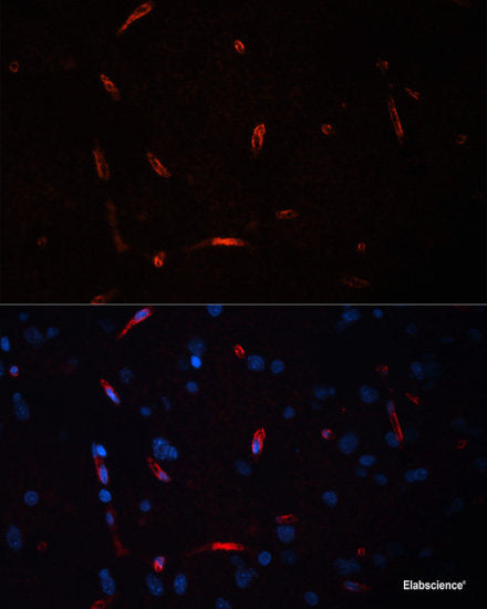 Immunofluorescence analysis of U2OS cells using ALDH1B1 Polyclonal Antibody at dilution of  1:100. Blue: DAPI for nuclear staining.