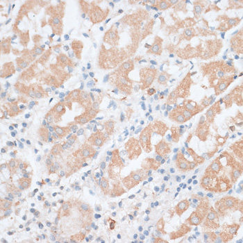Immunofluorescence analysis of U2OS cells using CHD1 Polyclonal Antibody at dilution of  1:100. Blue: DAPI for nuclear staining.