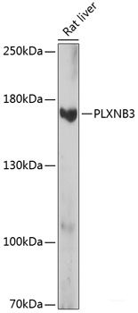 Immunofluorescence analysis of HeLa cells using CYP2A6 Polyclonal Antibody at dilution of  1:100 (40x lens). Blue: DAPI for nuclear staining.