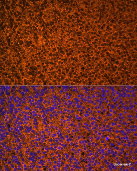 Immunohistochemistry of paraffin-embedded Rat kidney using DAPK3 Polyclonal Antibody at dilution of  1:100 (40x lens).
