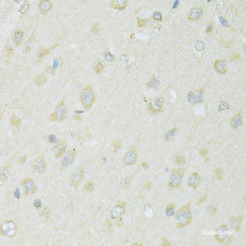 Immunofluorescence analysis of U2OS cells using GYPB Polyclonal Antibody at dilution of  1:100. Blue: DAPI for nuclear staining.