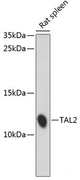 Immunofluorescence analysis of U2OS cells using IFNW1 Polyclonal Antibody at dilution of  1:100. Blue: DAPI for nuclear staining.