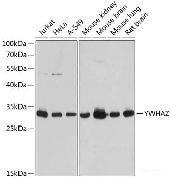 Immunofluorescence analysis of U2OS cells using LRP6 Polyclonal Antibody at dilution of  1:100. Blue: DAPI for nuclear staining.