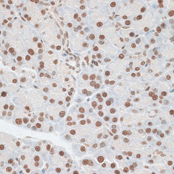 Immunofluorescence analysis of HUVEC cells using eNOS Polyclonal Antibody at dilution of  1:100 (40x lens). Blue: DAPI for nuclear staining.