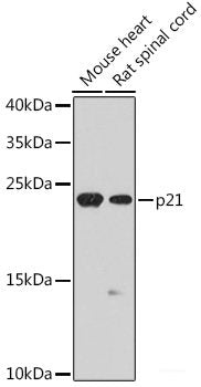 Immunofluorescence analysis of L929 cells using RPL28 Polyclonal Antibody at dilution of  1:100. Blue: DAPI for nuclear staining.