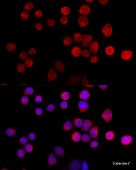 Immunofluorescence analysis of C6 cells using SSTR2 Polyclonal Antibody at dilution of  1:100 (40x lens). Blue: DAPI for nuclear staining.