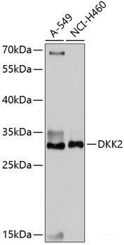 Immunofluorescence analysis of C6 cells using KSR1 Polyclonal Antibody at dilution of  1:100 (40x lens). Blue: DAPI for nuclear staining.
