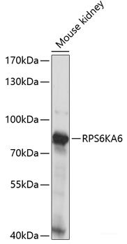 Immunofluorescence analysis of U2OS cells using UBA3 Polyclonal Antibody at dilution of  1:100. Blue: DAPI for nuclear staining.