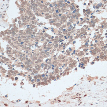 Immunofluorescence analysis of Mouse colon using GPA33 Polyclonal Antibody at dilution of  1:100. Blue: DAPI for nuclear staining.