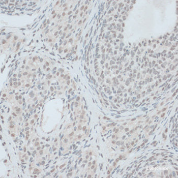 Immunofluorescence analysis of C6 cells using SEC23B Polyclonal Antibody at dilution of  1:100. Blue: DAPI for nuclear staining.