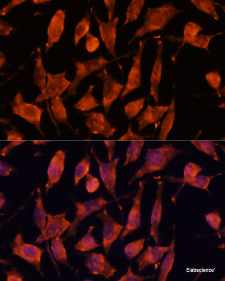 Immunohistochemistry of paraffin-embedded Human colon using CES2 Polyclonal Antibody at dilution of  1:100 (40x lens).