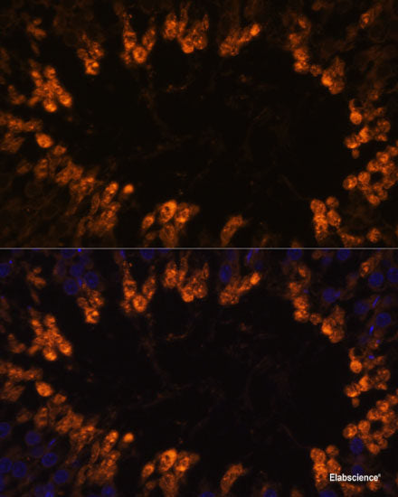 Immunofluorescence analysis of U2OS cells using NCAPH Polyclonal Antibody at dilution of  1:100. Blue: DAPI for nuclear staining.
