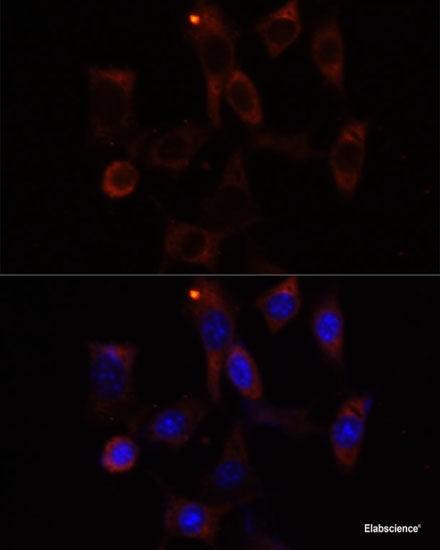 Immunofluorescence analysis of Rat brain using SLC17A6 Polyclonal Antibody at dilution of  1:100 (40x lens). Blue: DAPI for nuclear staining.