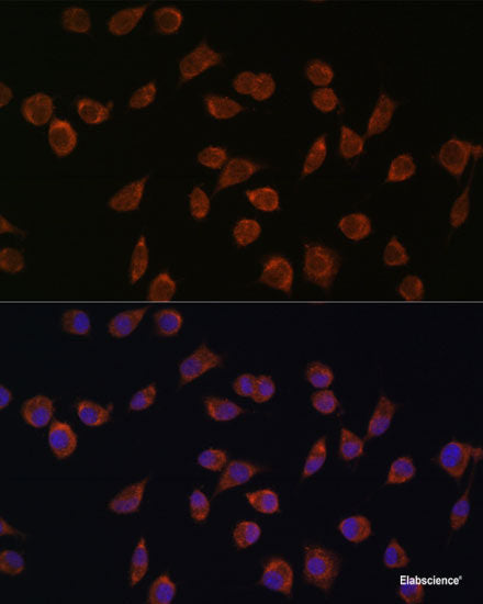 Immunofluorescence analysis of U2OS cells using MCCC2 Polyclonal Antibody at dilution of  1:100. Blue: DAPI for nuclear staining.