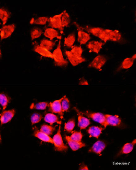 Immunofluorescence analysis of U2OS cells using TCTN2 Polyclonal Antibody at dilution of  1:100. Blue: DAPI for nuclear staining.