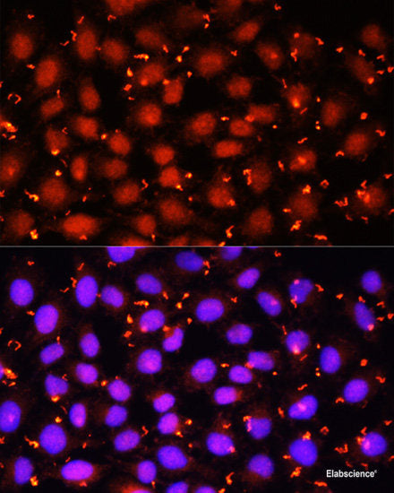 Immunofluorescence analysis of U2OS cells using ARL6 Polyclonal Antibody at dilution of  1:100. Blue: DAPI for nuclear staining.