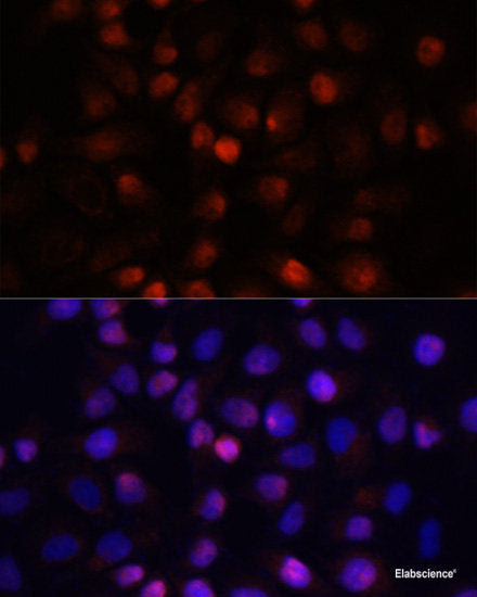 Immunohistochemistry of paraffin-embedded Rat brain using PRMT5 Polyclonal Antibody at dilution of  1:100 (40x lens).