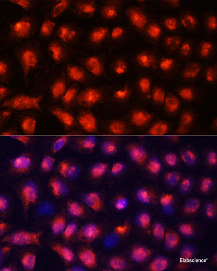 Immunofluorescence analysis of U2OS cells using ATG4C Polyclonal Antibody at dilution of  1:100. Blue: DAPI for nuclear staining.